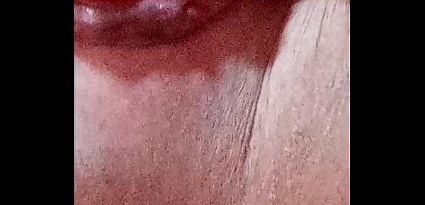  Joe&039;s prolapse anus